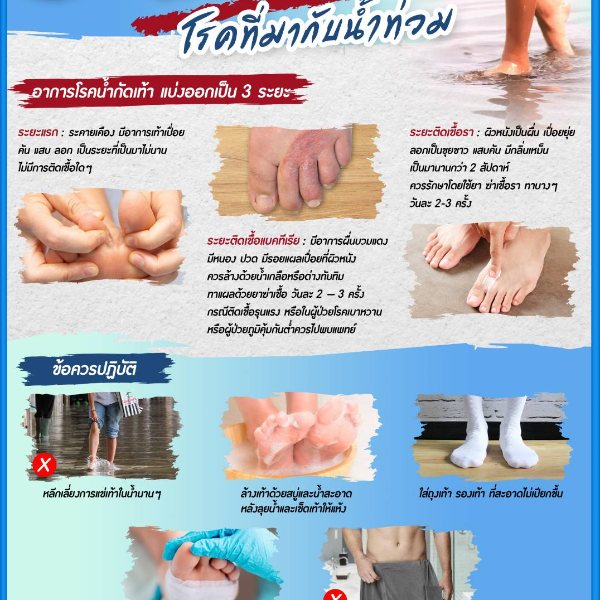 น้ำกัดเท้า โรคที่มากับน้ำท่วม